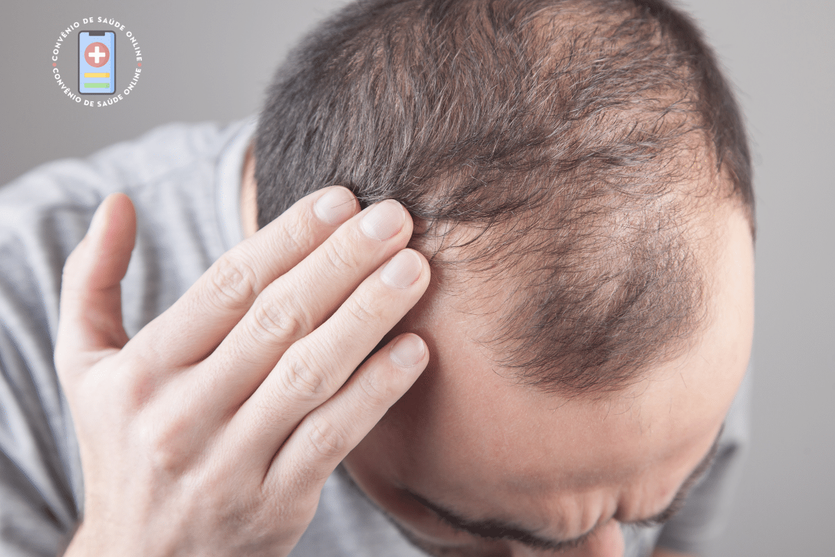 Alopecia e queda de cabelo: causas, prevenção e tratamentos